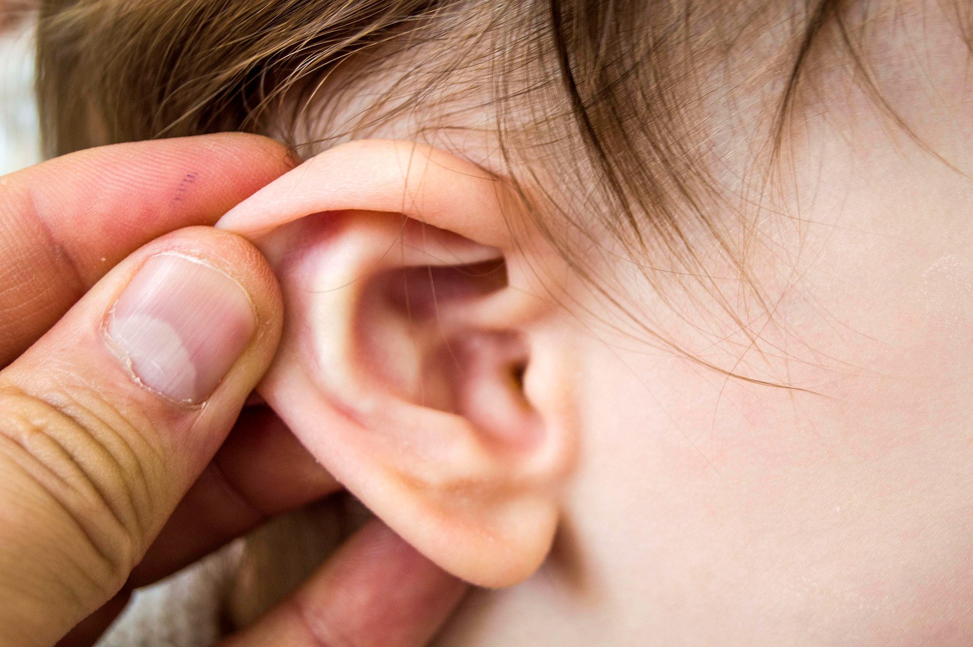 Đeo tai nghe nhiều có những ảnh hưởng tiêu cực ra sao? Sau đây là câu trả lời cho bạn - ảnh 5