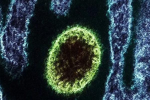 Trung Quốc phát hiện loại virus mới, chưa có thuốc chữa - ảnh 1