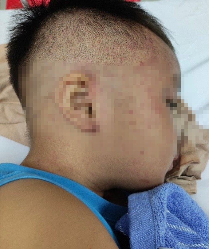NÓNG: Cứu kịp thời bé trai 3 tuổi ở Hà Nam nghi bị bạo hành, nhốt trong tủ cấp đông - ảnh 1
