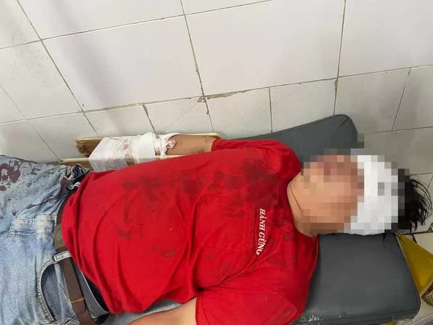 Một người bị chém gần đứt lìa cánh tay ở TP Thủ Đức - ảnh 1