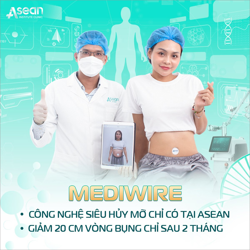 Dịch vụ giảm béo Mediwire tại Thẩm mỹ Quốc tế Asean có gì đặc biệt? - ảnh 2