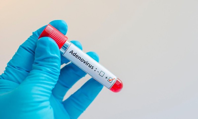 Adenovirus tiếp tục chạm mốc hơn 1.400 ca, 7 trẻ tử vong: Cha mẹ cần phân biệt rõ với bệnh hô hấp thông thường - ảnh 2