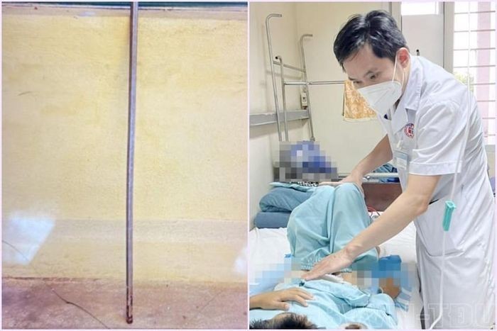Quảng Ninh: Bé trai 11 tuổi bị thanh sắt dài đâm vào chỗ hiểm vì trò đùa dại của bạn học - ảnh 1