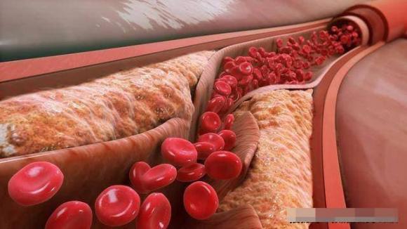 Ăn khoai lang có làm tăng lipid máu hay giảm lipid máu? Có thể nhiều người ăn nhầm - ảnh 5