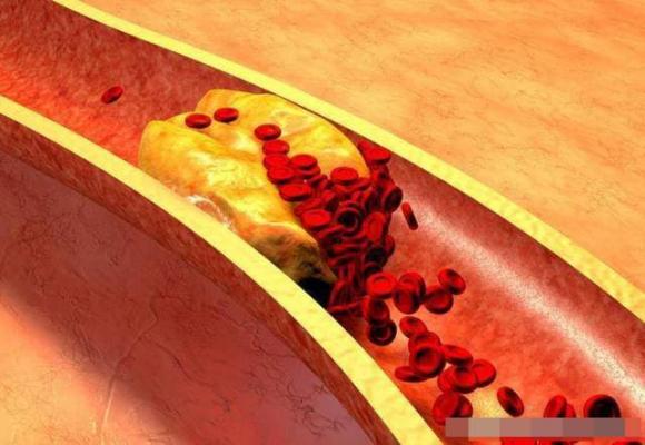 Ăn khoai lang có làm tăng lipid máu hay giảm lipid máu? Có thể nhiều người ăn nhầm - ảnh 6