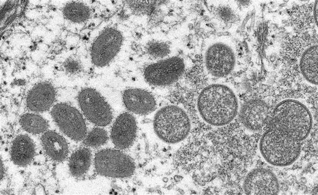 TP.HCM: Bệnh nhân đầu tiên mắc đậu mùa khỉ đã âm tính với virus - ảnh 1
