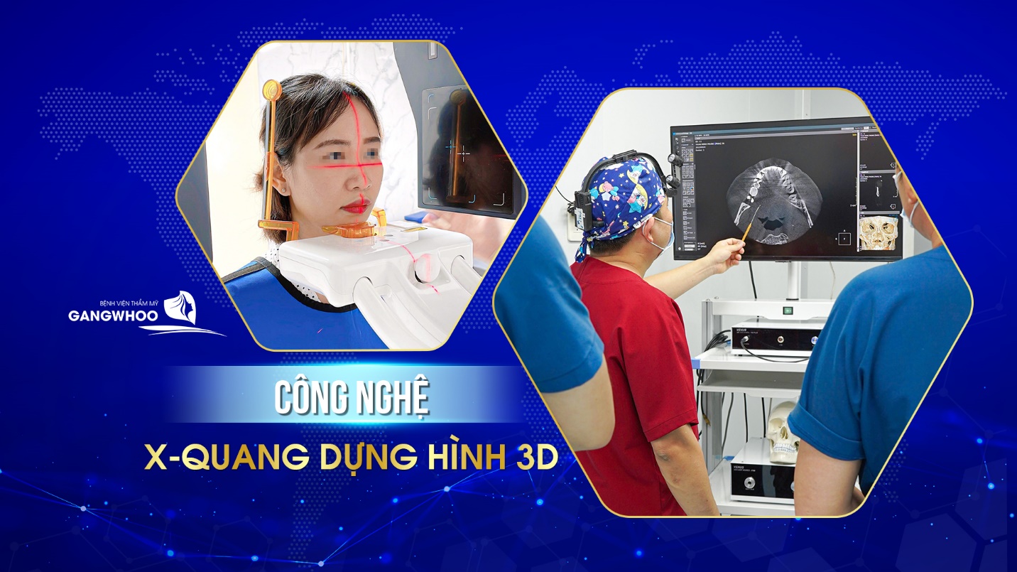 Bệnh viện thẩm mỹ Gangwhoo tung ưu đãi lớn mừng ngày Phụ nữ Việt Nam 2022 - ảnh 5