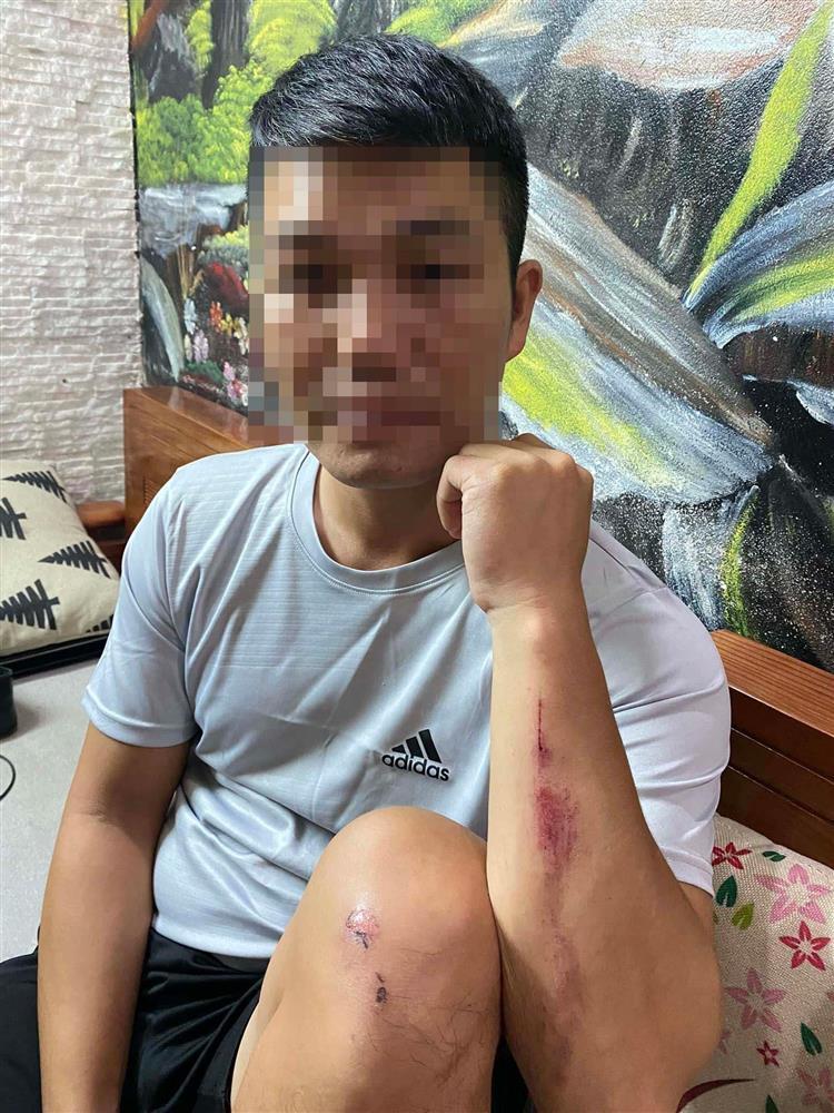 Nhiều người đi đường ở Hà Nội bị tấn công bằng vỏ chai - ảnh 1