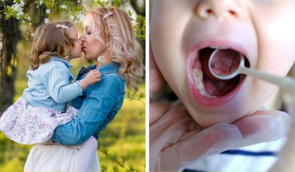 Khoa học giải thích điều gì có thể xảy ra nếu chúng ta hôn lên miệng con cái - ảnh 1