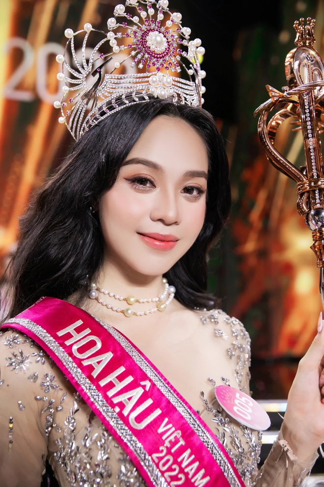 Hoa hậu Thanh Thủy bị nghi phẫu thuật thẩm mỹ, thái độ của netizen mới bất ngờ - ảnh 3