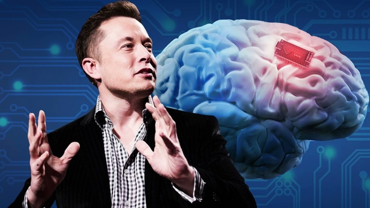 Elon Musk cấy chip vào não người như thế nào? - ảnh 1
