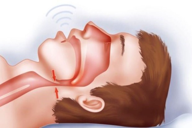 Bác sĩ tim mạch: Tiếng ngáy khi ngủ phản ánh tình trạng sức khỏe không thể bỏ qua - ảnh 1
