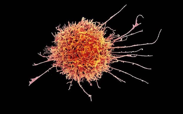 Đột phá mới trong nghiên cứu điều trị bệnh ung thư máu hiếm gặp - ảnh 1