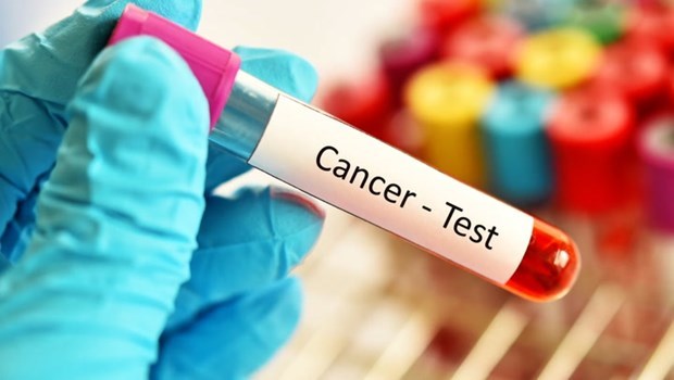 Australia đạt được bước đột phá trong việc sàng lọc ung thư ruột - ảnh 1