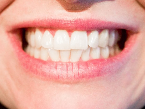 Nghiên cứu thuốc có khả năng kích thích răng mọc trở lại - ảnh 1