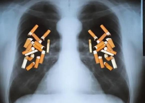 Sau khi cai thuốc lá thành công, phổi có trở lại bình thường được không? Bác sĩ nhắc nhở: Cố gắng không vượt quá độ tuổi này khi bỏ thuốc lá - ảnh 3