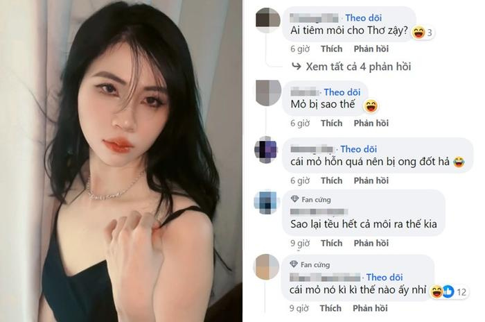 Youtuber Thơ Nguyễn ''lột xác'' xinh đẹp sau phẫu thuật thẩm mỹ nhưng vẫn bị chê điểm này - ảnh 4