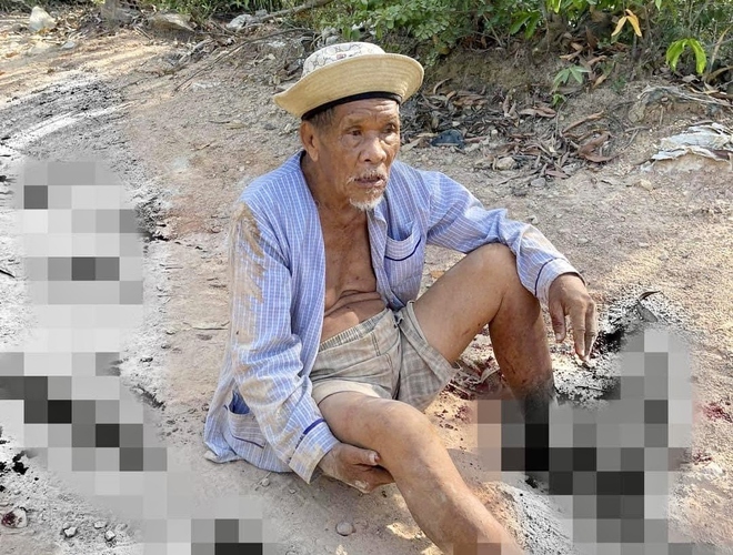 Điều tra vụ cụ ông 85 tuổi bị dập nát 2 bàn chân - ảnh 1