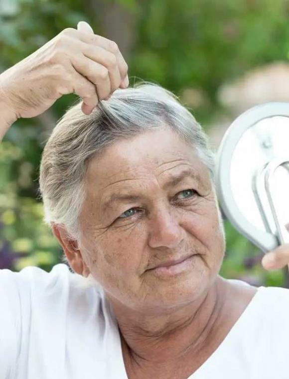 Cơ thể thiếu hụt vitamin nào sẽ khiến tóc bạc? Tóc bạc có nhổ được không? Có lẽ bạn sẽ hiểu sau khi đọc bài viết này - ảnh 1