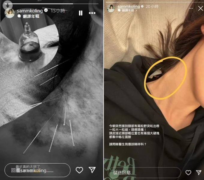 'Mỹ nhân cảnh nóng TVB' Cao Hải Ninh gặp vấn đề sức khỏe, nhập viện sau khi phát hiện khối u bất thường - ảnh 2