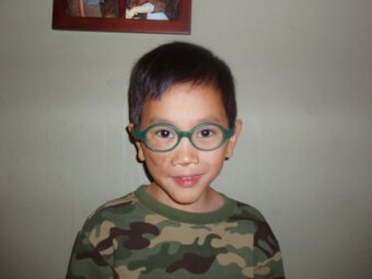 Cậu bé gốc Việt bị khối u che nửa mặt “lột xác” sau khi được bố mẹ Mỹ nhận nuôi