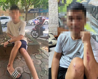Hà Nội: Truy tìm nhóm "tóc xanh, tóc đỏ" vô cớ dùng vỏ chai bia tấn công người đi đường