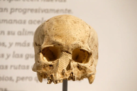 18.000 chiếc sọ người ở bảo tàng Pháp thuộc về ai?