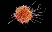 Đột phá mới trong nghiên cứu điều trị bệnh ung thư máu hiếm gặp