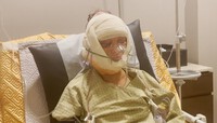 Người phụ nữ 57 tuổi đến Hàn Quốc phẫu thuật thẩm mỹ và cái kết "cải lão hoàn đồng" ngoạn mục