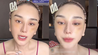 Lâm Khánh Chi livestream với gương mặt bầm tím, chuyện gì đây?