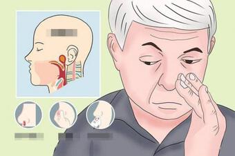 Khi ung thư vòm họng xuất hiện, cơ thể có 5 ''cảnh báo''. Đừng nhầm lẫn với bệnh viêm mũi