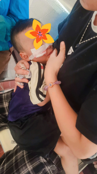 Kinh hoàng em bé 17 tháng tuổi bị trâu húc rách mặt ở Nghệ An