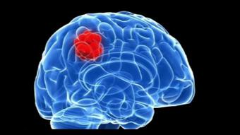 Ca sĩ Lương Bích Hữu phát hiện khối u trong não sau tai nạn: Tình hình sức khỏe mới nhất